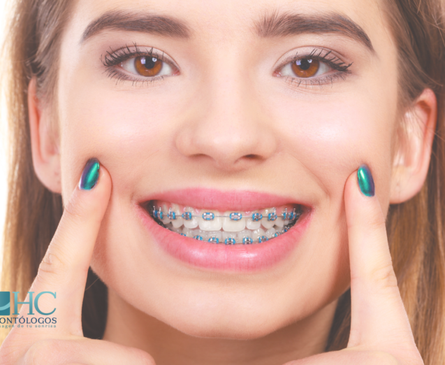 ¿Cómo eliminar el dolor al usar brackets? - Dr. Rubén Herrera | Especialista en Ortodoncia - Ortodoncia Merida